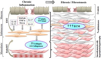 The Role of Cytokines in the Fibrotic Responses in Crohn’s Disease